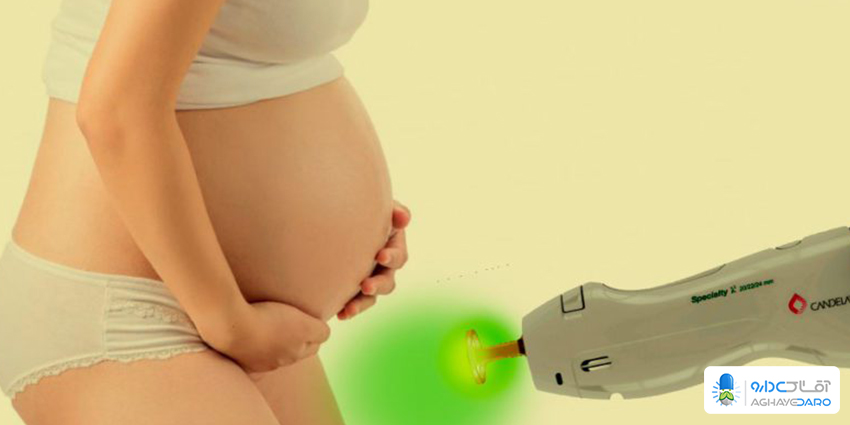 پیشگیری عوارض جانبی لیزر موهای زائد