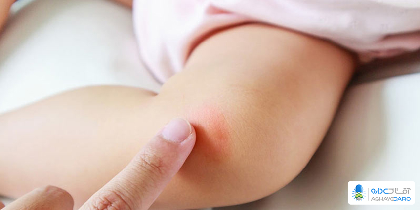 راه‌های جلوگیری از گزش پشه در سفر