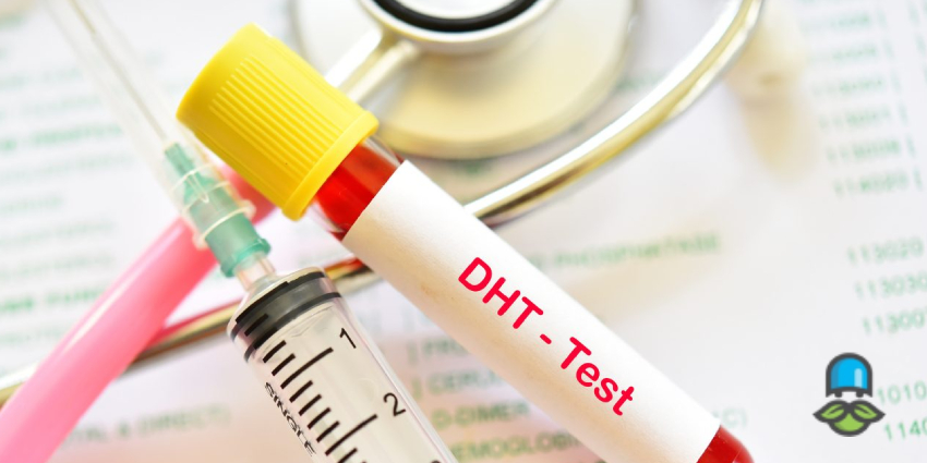 درباره هورمون DHT چه می‌دانید؟ - تصویر 4