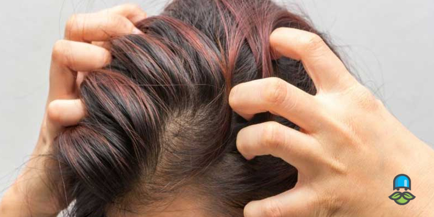 مراقبتهای جانبی برای تسکین خارش سر