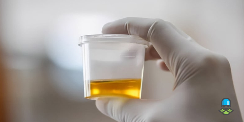 پروتئینوری یا دفع پروتئین از کلیه چیست؟