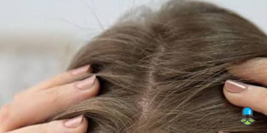 ریزش مو در دوران بارداری چیست؟