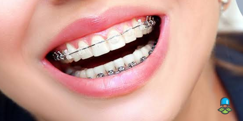   ارتودنسی چه عوارضی دارد؟